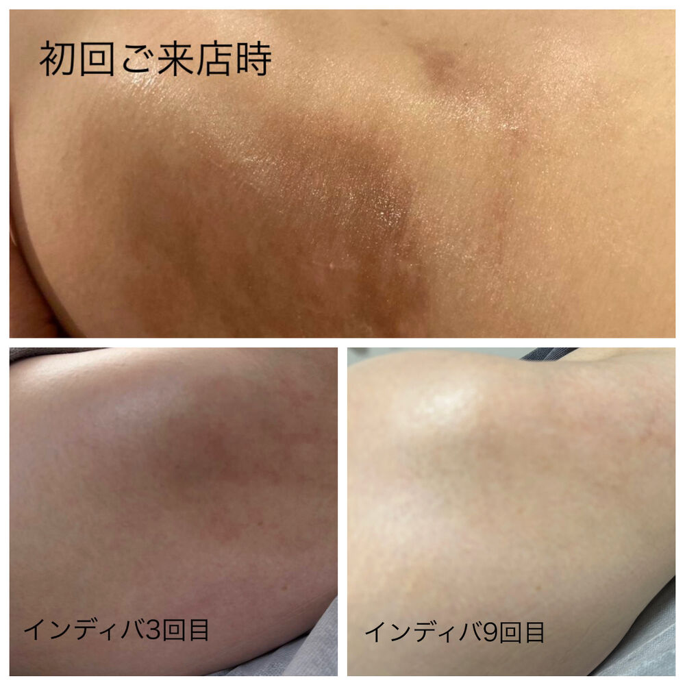 画像2890